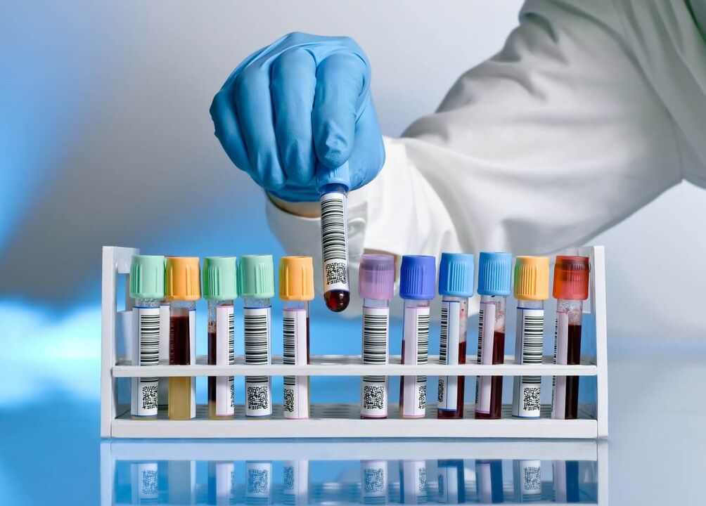 blood test to detect pathology when stimulated