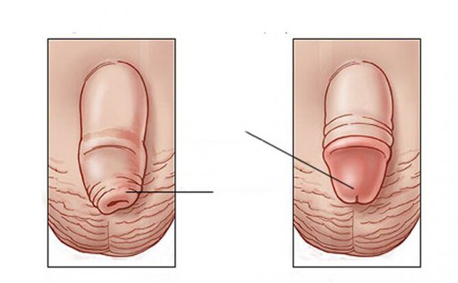 What is the task that the lubricant is done