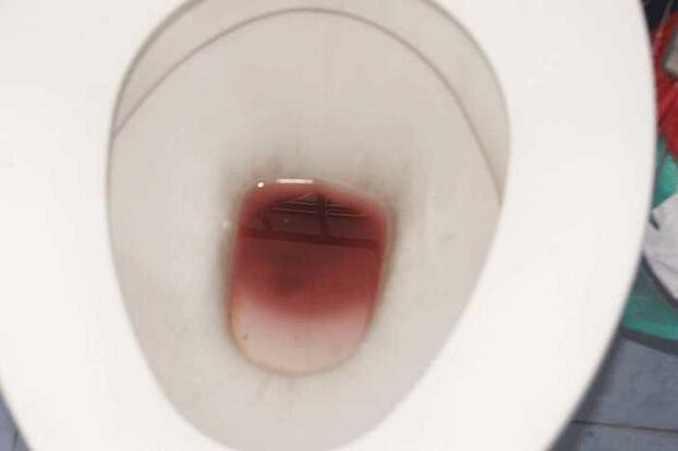 Spotting in men when aroused